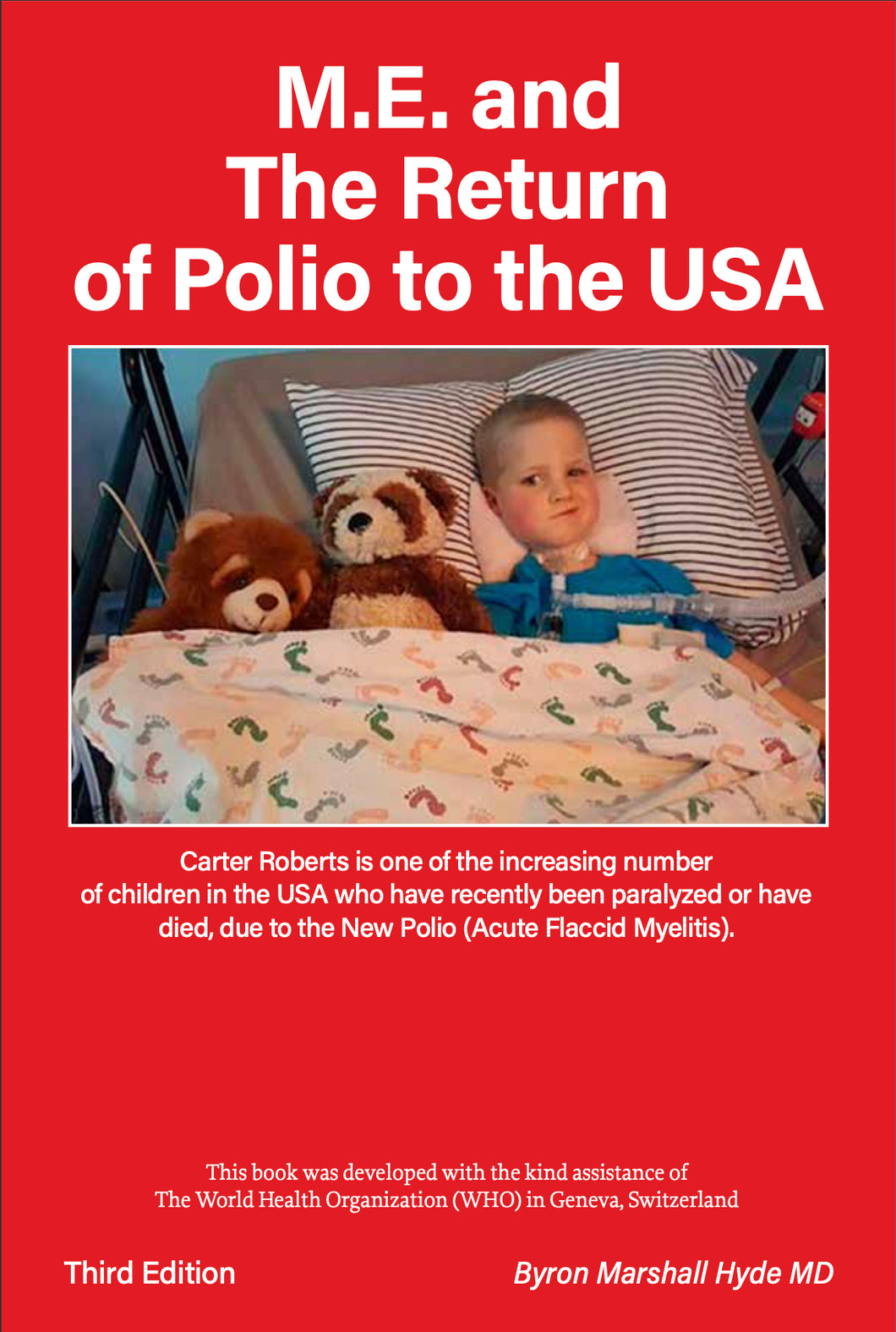 Hardcover - M.E. and The Return of Polio to the USA - 3rd Edition